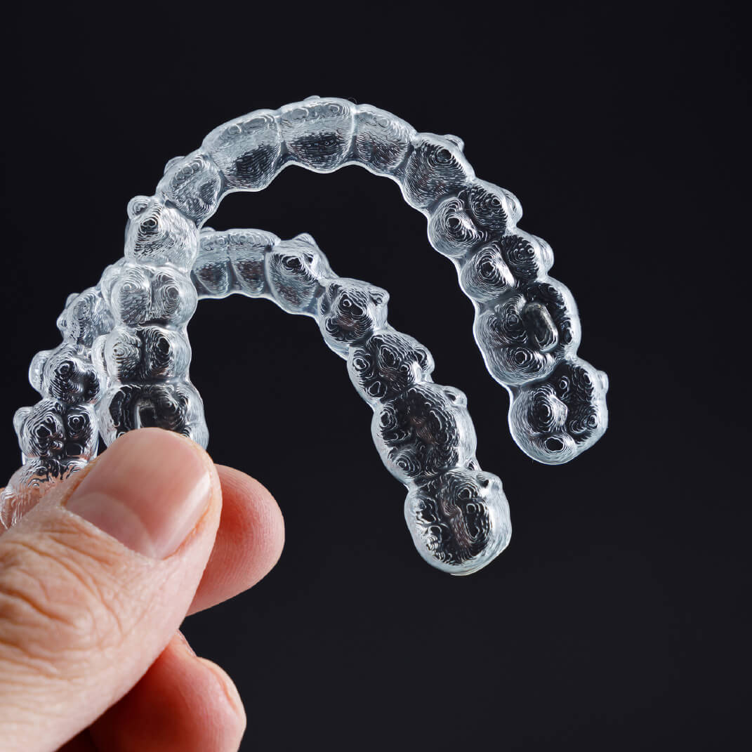 3M Clarity Aligners | National Orthodontics