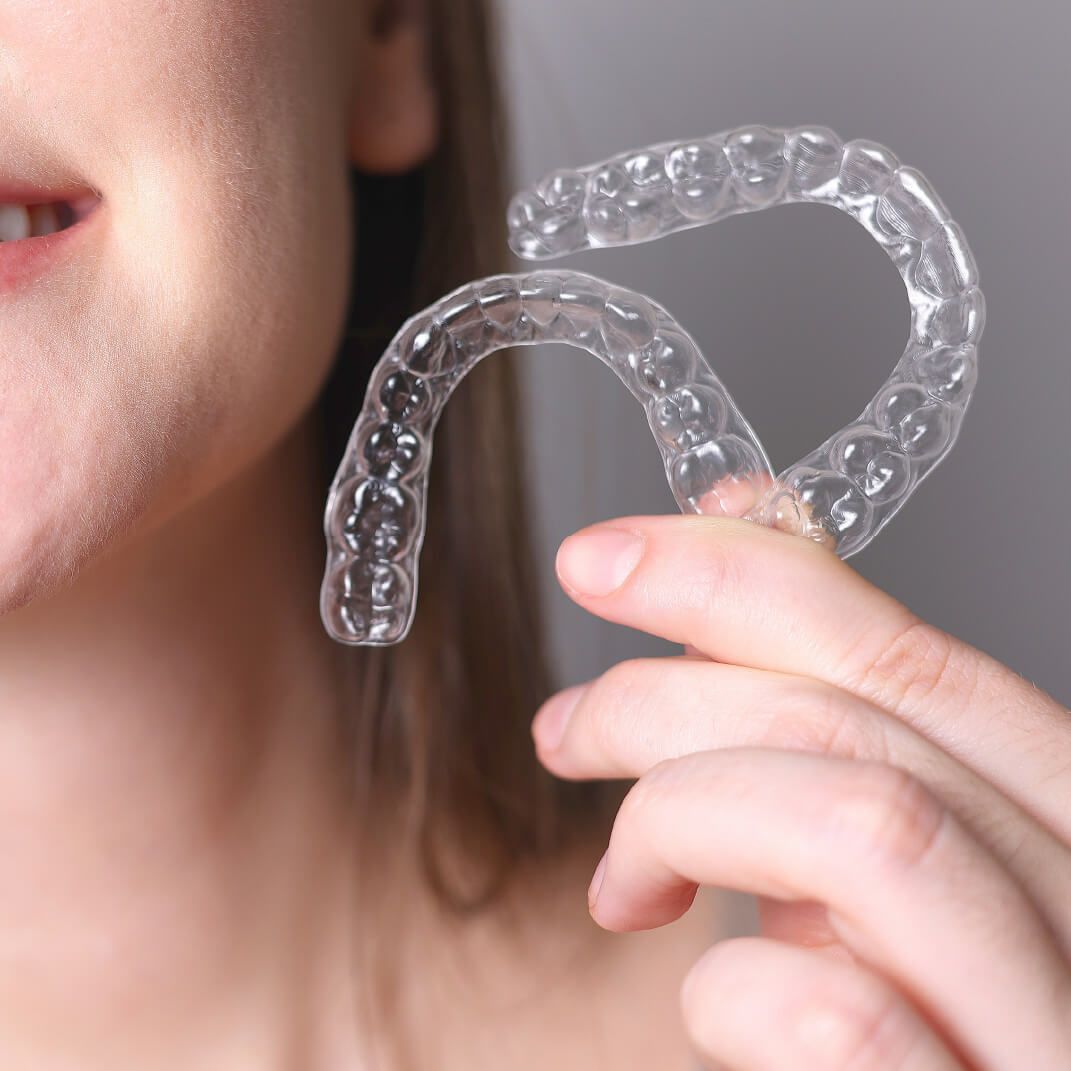 Benefits of 3M Clarity Aligners