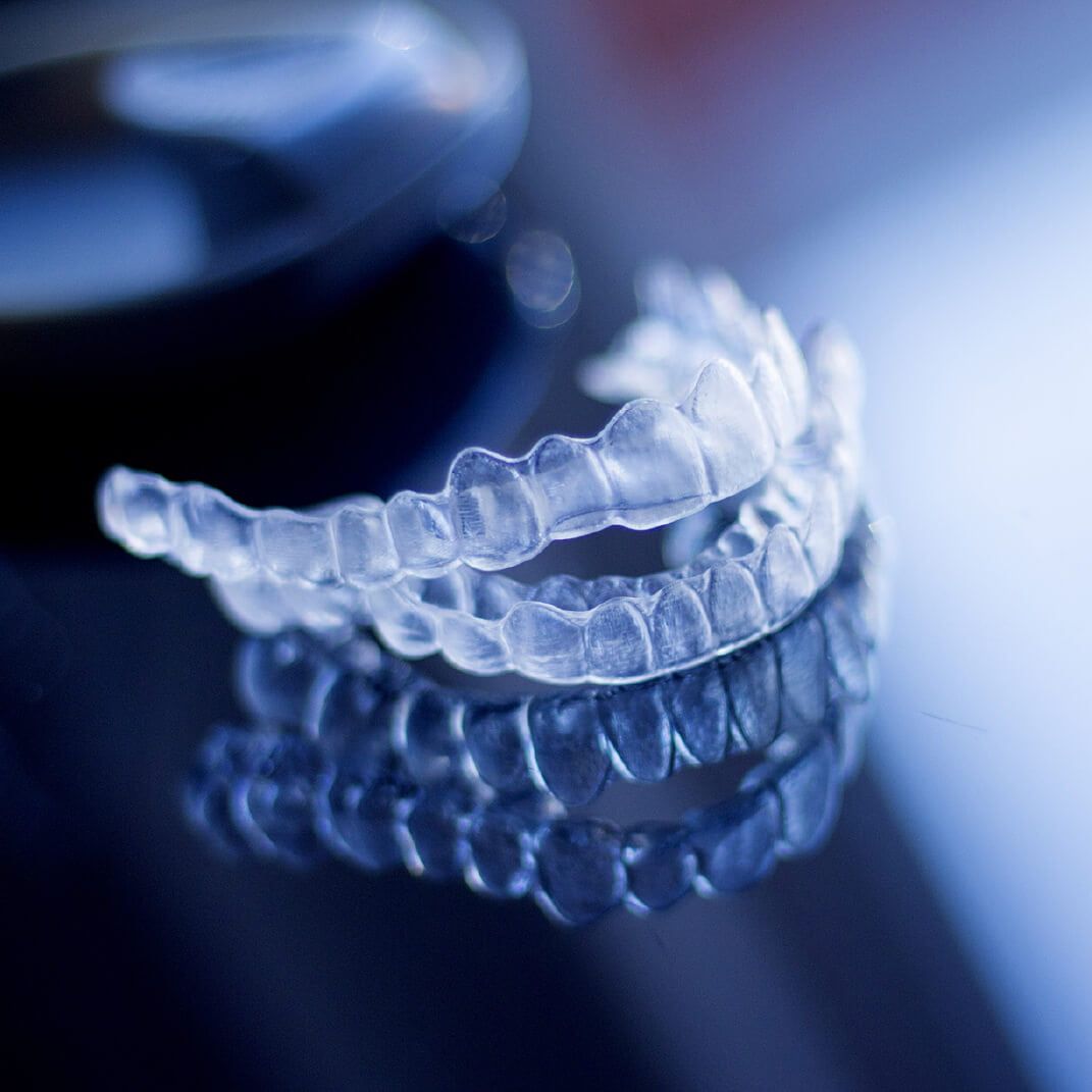 Care Tips for 3M Clarity Aligners