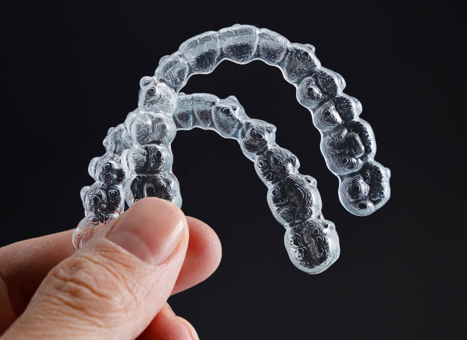 3M Clarity Aligners | National Orthodontics