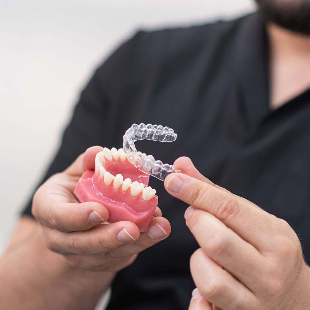 Benefits of Clear Aligners