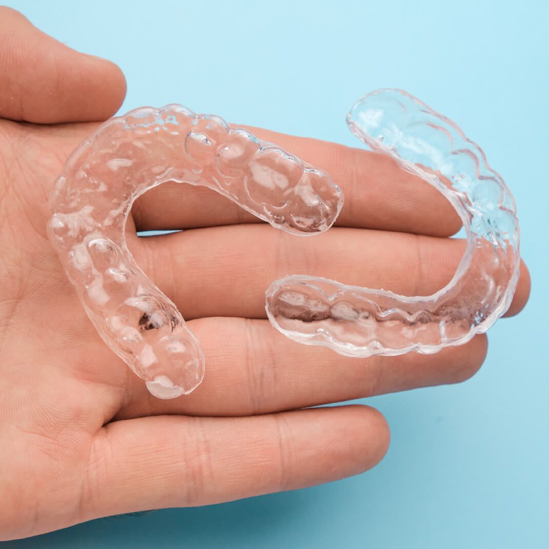 Care Tips for OrthoFX Aligners